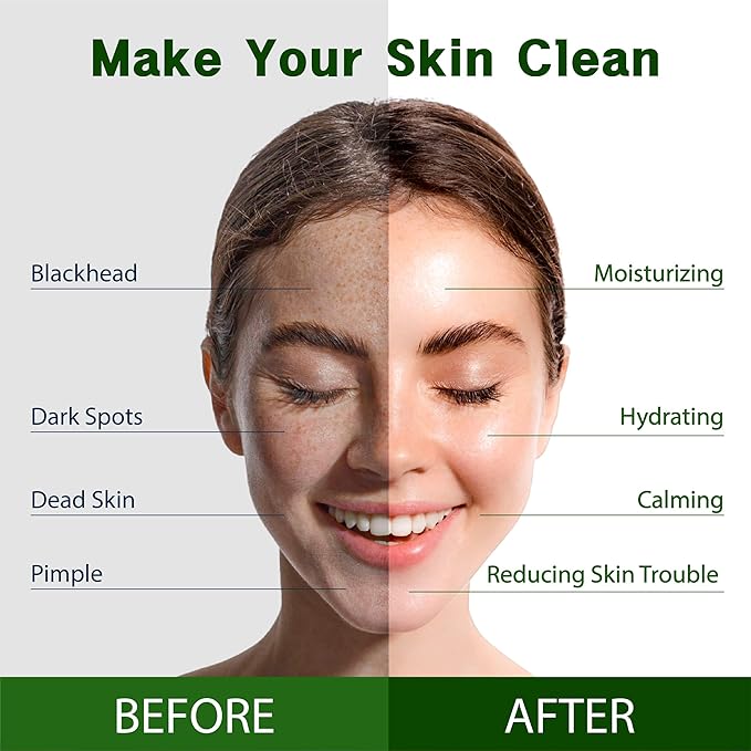 Purederm Vegan Tea Tree Sheet Masks (12 Packs) ??Facial Sheet Mask for Calming & Trouble Reducing Treatment